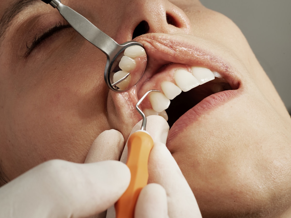 DENTAL DISCOUNTS